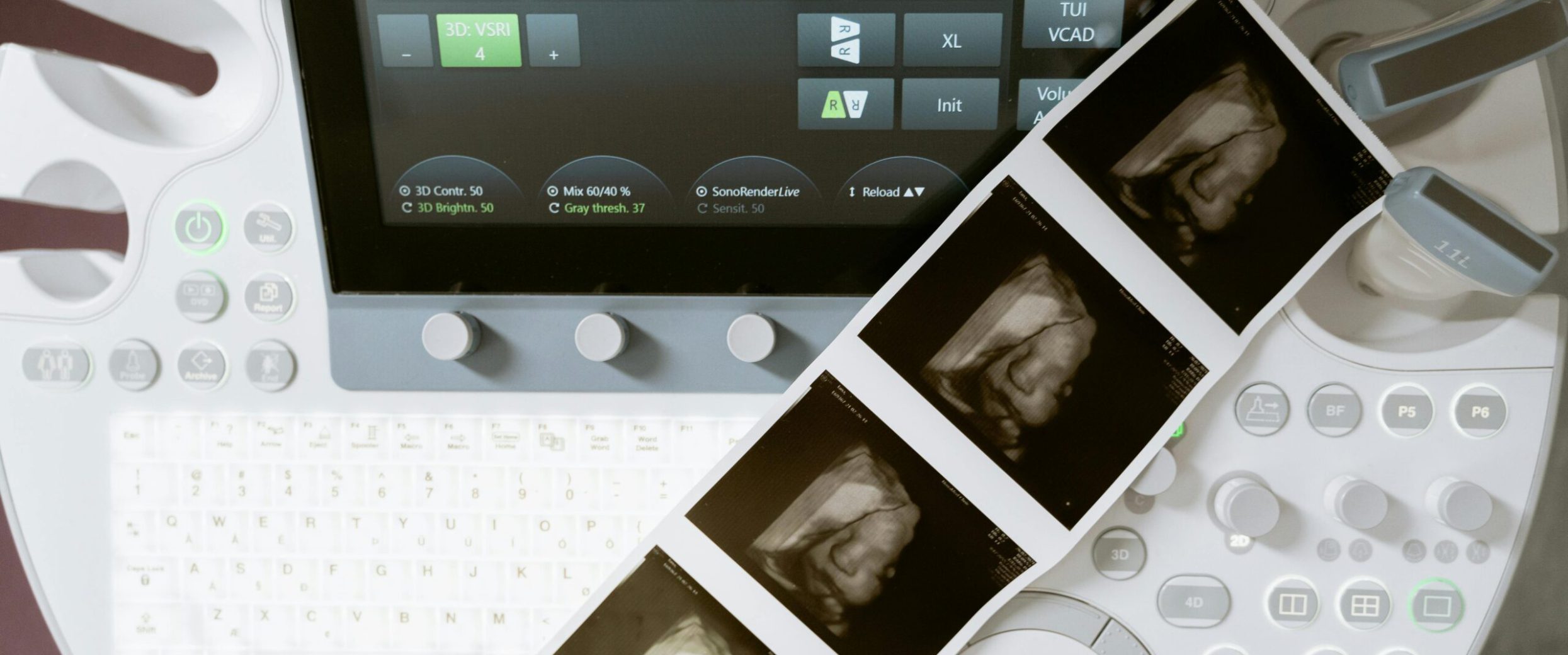 Badania USG prenatalne – klucz do bezpiecznej ciąży i zdrowia dziecka